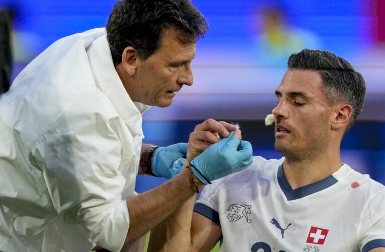 Euro 2024: Switzerland’s unlucky Schar breaks nose minutes after role in Scotland goal