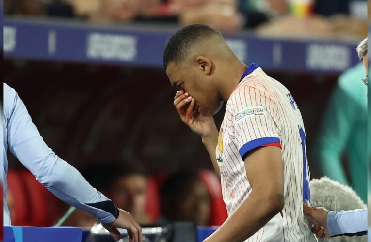 Kylian Mbappe Injury Leaves France To Prepare Plan B At Euro 2024